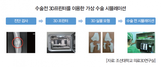 3D프린터 통해 맞춤형 장기, 생생한 임상교육