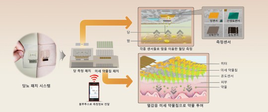 당뇨패치 시스템/자료=IBS