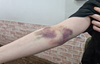 교차접종 괜찮다더니…\