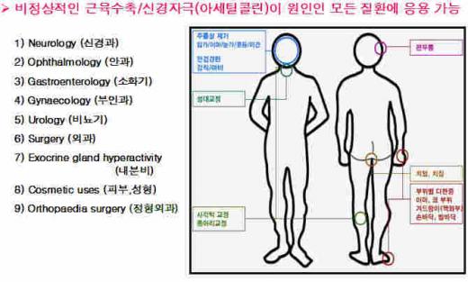 보톡스 적용사례        