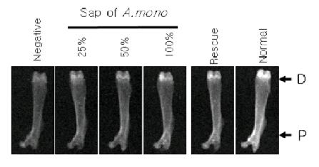 ٰ ߵ   X-ray . negative   , 25% 50%, 100%  μ   󵵷  , resque Į Ḧ  , normal ٰ   ̴.     е  ǹѴ.