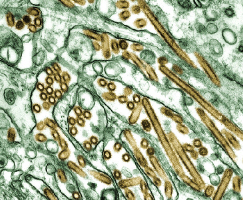 ↑H5N1 바이러스의 전자마이크로그래픽