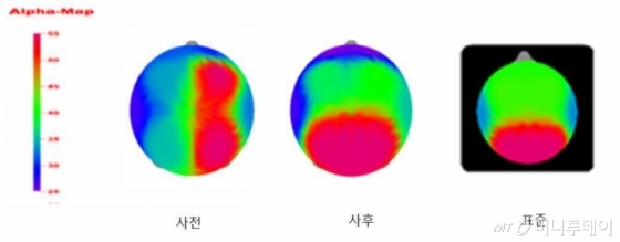 세이브더칠드런이 진행한 연구 결과 한 아동의 알파파 맵. 매주 한시간 씩 놀기 전(왼쪽)보다 4개월간 놀이시간을 가진 후(중간) 에 좌우 전두엽 기능이 활성화 되고 좌우 불규형도 개선됐다. 맨 오른쪽은 건강한 전두엽 기능을 보여주는 표준 알파파 분포./사진제공=세이브더칠드런