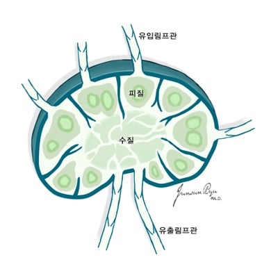 악성림프종의 발병 부위. /사진=국가암정보센터