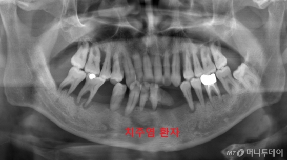 치과 파노라마영상 찍었더니…
