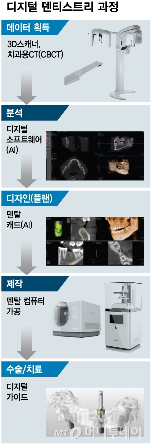 임플란트 대표주자 '치과 토탈솔루션' 선두주자로 - 머니투데이 임플란트 대표주자 '치과 토탈솔루션' 선두주자로 - 머니투데이