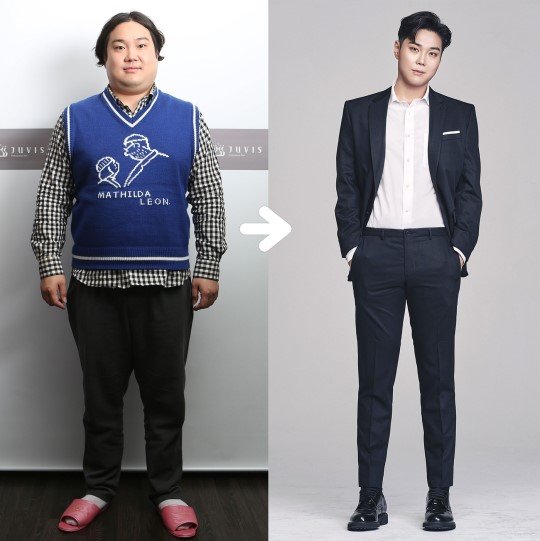 104kg에서 72kg으로 감량한 유재환 다이어트 전후 모습/사진 제공=쥬비스