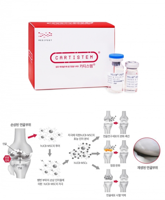 메디포스트가 개발한 골관절염 치료제 '카티스템'과 치료 원리. /사진제공=메디포스트