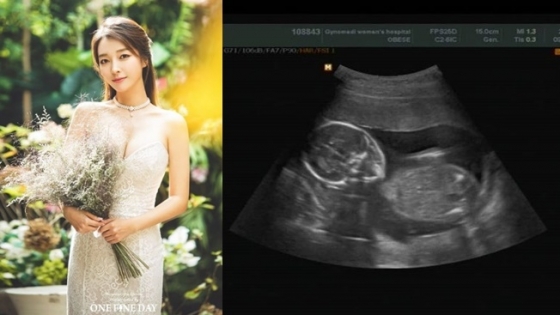 가수 이상미가 5일 결혼 13일 만에 임신 20주차임을 고백했다./사진=이상미 인스타그램 캡처