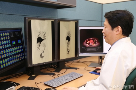 서울아산병원 핵의학과 문대혁 교수가 PET-CT사진을 판독하고 있다./사진제공=서울아산병원