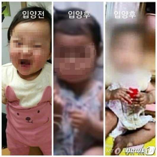 생후 16개월 영아가 사망한 사건과 관련, 입양 전(왼쪽)과 입양 후(가운데, 오른쪽) 모습이 담긴 사진이 공개됐다./사진=뉴스1