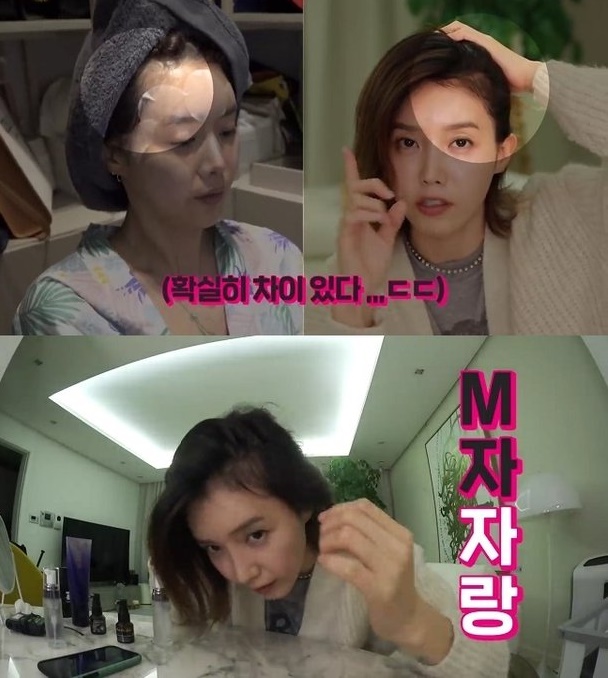 채정안 "M자 탈모 극복했다" 깜짝 고백…비결은?
