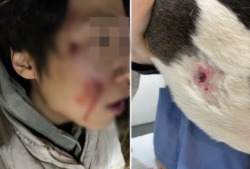 경기도 가평군에서 목줄과 입마개를 안 한 로트와일러가 A씨와 반려견을 공격하는 사고가 발생했다. /사진=온라인 커뮤니티 캡처