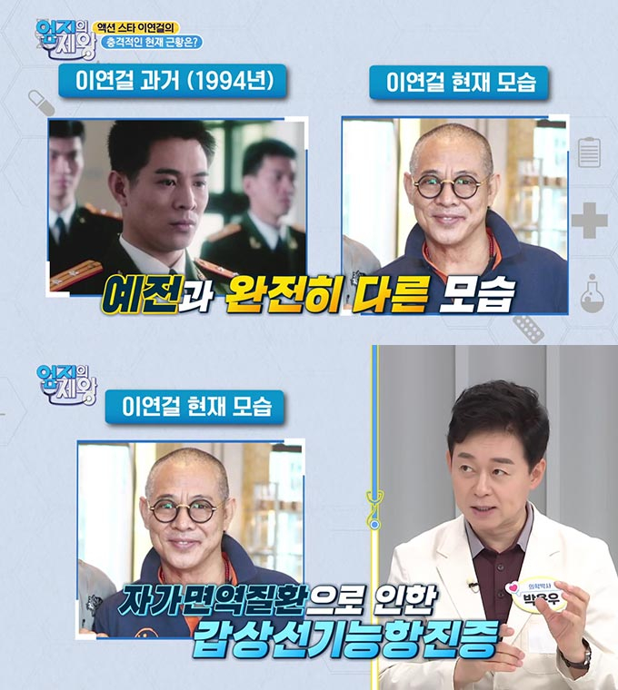 /사진=MBN &#039;엄지의 제왕&#039; 방송 화면 캡처