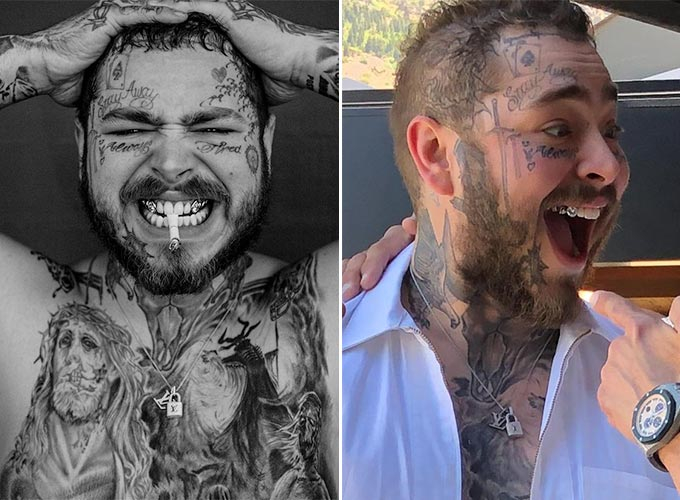 팝 스타 포스트 말론(Post Malone)/사진=치과의사 토마스 코넬리 인스타그램