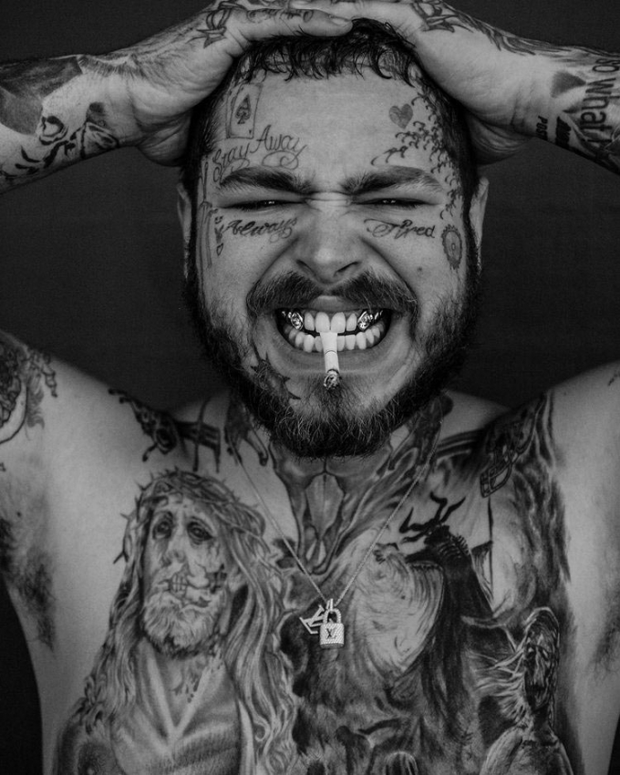 팝 스타 포스트 말론(Post Malone)/사진=치과의사 토마스 코넬리 인스타그램