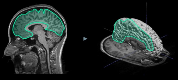 메디라벨 '3D Fill' 기능