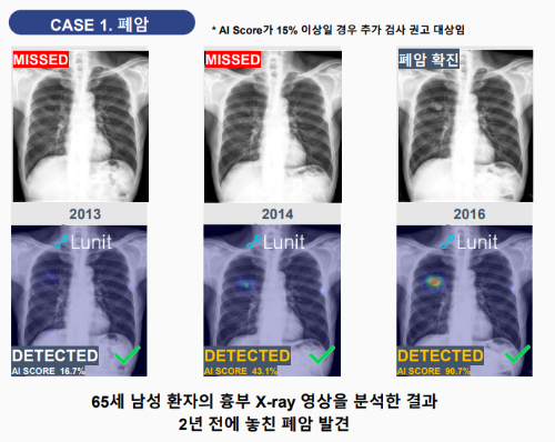 사진=루닛 제공