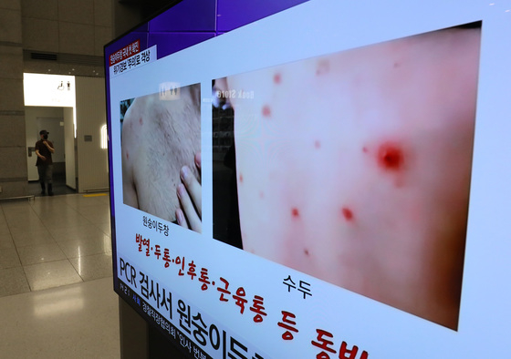 23일 인천공항 제1터미널 입국장 TV에 원숭이두창 관련 뉴스가 나오고 있다. /사진=뉴스1