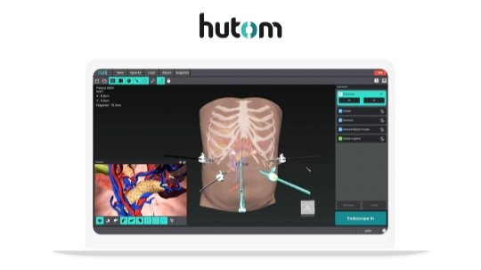 의료에도 '디지털 트윈' 접목…휴톰, 정부 임상연구 지원사업 선정