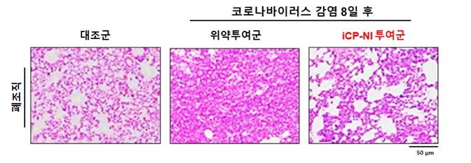 코로나19 바이러스(SARS-CoV-2) 감염 실험동물의 손상된 폐 구조가 iCP-NI 투여군에서는 정상수준으로 회복된 것으로 확인됐다. /사진제공=셀리버리