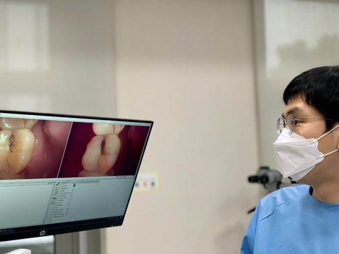 의료진이 큐레이로 촬영한 환자의 균열치아 사진을 살펴보고 있다. 모니터 안 오른쪽 이빨에 빨간 선이 보여 균열치아를 확인할 수 있다. /사진제공=신수정 교수