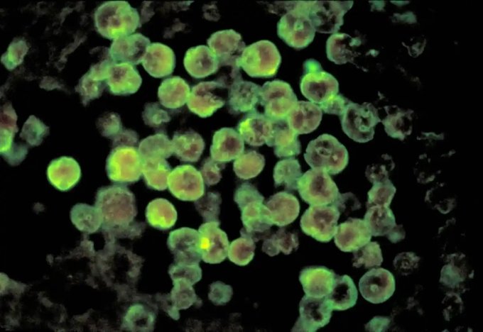 뇌 먹는 아메바로 알려진 &#039;네글레리아 파울러리&#039;를 현미경으로 본 모습 /사진=미국 CDC