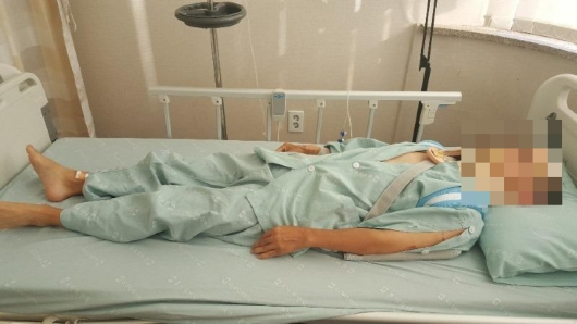 전동킥보드에서 뺑소니를 당해 목뼈와 두개골에 금이 가는 피해를 입은 남성 /사진=온라인 커뮤니티