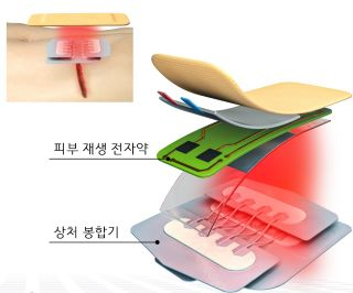 피부 재생 전자약이 결합된 스킨클로져/사진=서지너스 