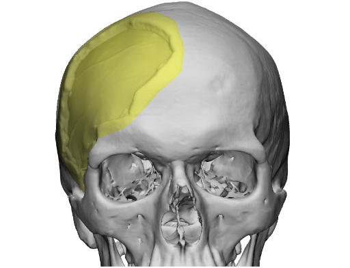 티앤알바이오팹의 3D 바이오프린팅 기술을 접목한 두개골 스캐폴드(PSI, Patient Specific Implant) 관련 사진. /사진제공=티앤알바이오팹