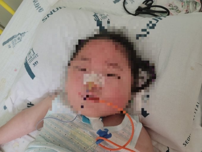 미혼모 김모씨(46)의 두살 아들에게는 뇌병변 장애가 있다. 아들은 면역력이 약하다. 지난달 패혈증으로 병원에 입원해 산소호흡기를 단 모습./사진제공=김모씨