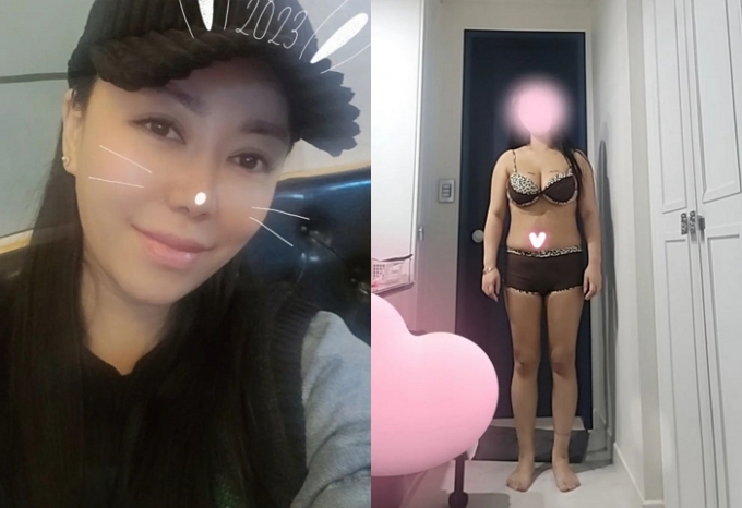 50억 자랑한 '나솔' 정숙, 복부지방 제거 수술…달라진 몸매 눈길 - 머니투데이