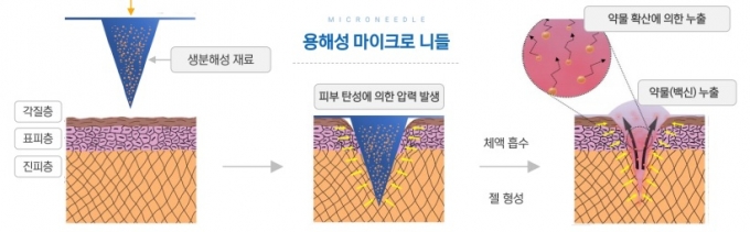 자료사진=동우글로벌
