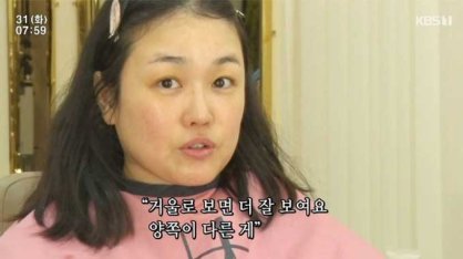 '설암 3기' 정미애 "비뚤어진 얼굴…투병 숨긴 이유? 자존심"