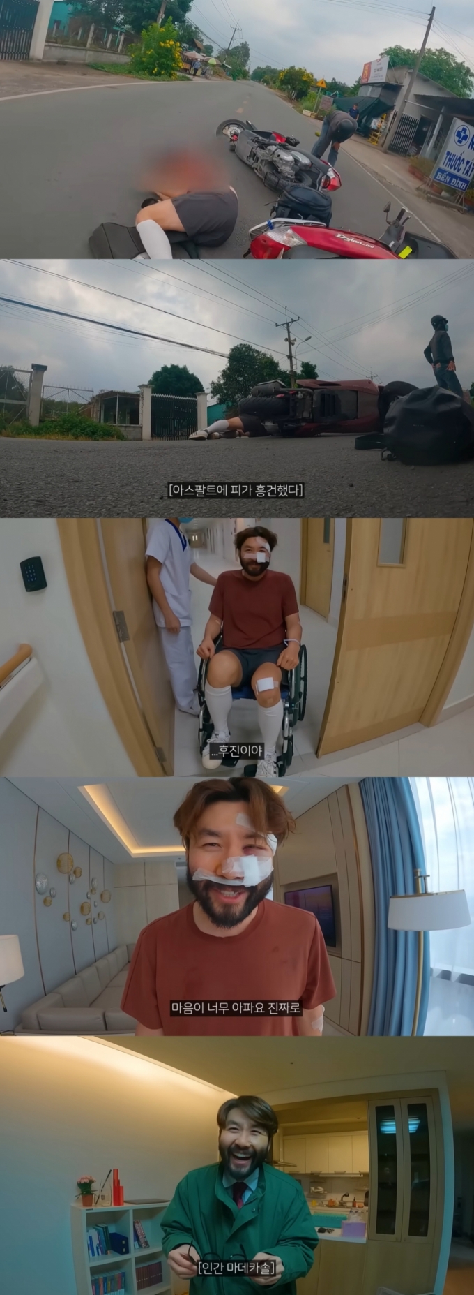 베트남에서 오토바이 사고를 당한 방송인 노홍철 /사진=유튜브 채널 '빠니보틀' 캡처