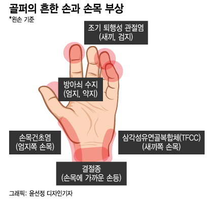 "손 아프면 무조건 골프 쉬세요"…나이스샷 대가는 '1톤 충격'