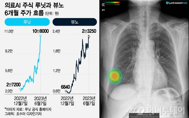 '암 정복의 꿈' 타고 3만원→11만원..300% 급등한 의료AI株 열풍