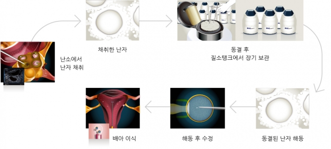 난자를 얼렸다가 임신을 계획할 때 꺼내 해동하는 과정 /그림=차병원