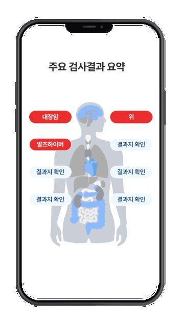 랩지노믹스, AI 헬스케어 '얼리큐' 서비스 확대 …22조 PNH 시장 진출