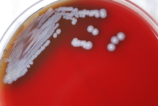 지난해 7월 미국 질병통제예방센터가 공개한 유비저균의 모습./사진=AP=뉴시스