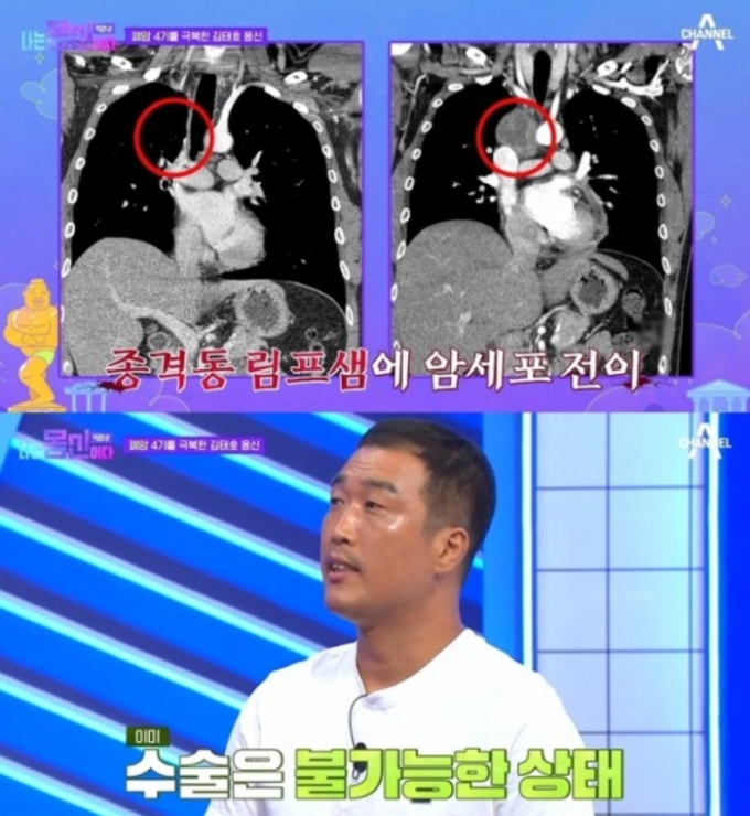/사진=채널A '나는 몸신이다 시즌2'