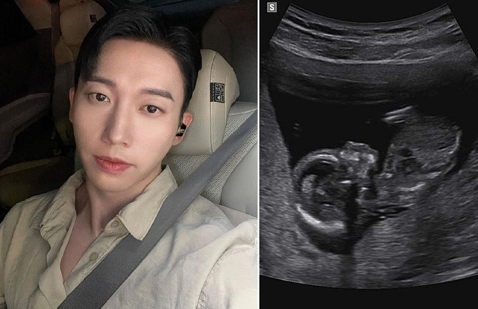 /사진=그룹 유키스 훈 인스타그램