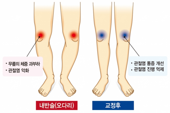 ٸ     ׸. /׸=뺴