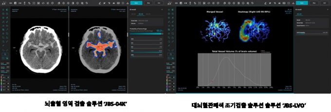 뇌출혈 영역 검출 인공지능 솔루션인 ‘JBS-04K’(사진 왼쪽)과 혈관시술 결정 분석 솔루션인 ‘JBS-LVO’ 운영 화면./사진=제이엘케이