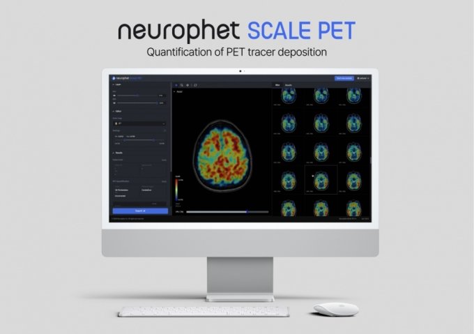 양전자 방출 단층 촬영(PET) 자동 영상 분석 소프트웨어 &#039;뉴로핏 스케일 펫(Neurophet SCALE PET)&#039;