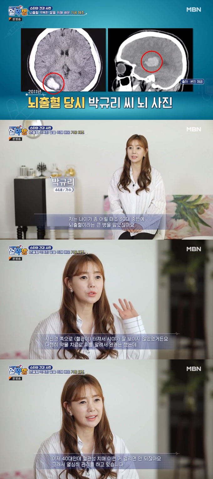 /사진=MBN '알약방' 방송 화면