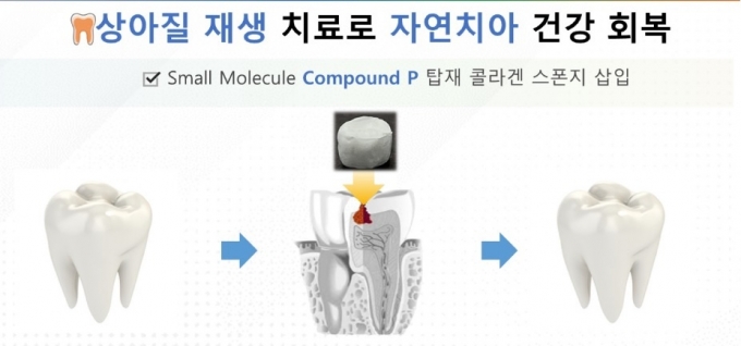 /그래픽=스템덴