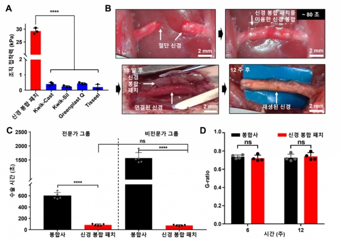 신경 봉합 패치의 접착력과 신경 봉합 과정 및 성능을 나타낸 사진과 표. 사진 B는 신경 봉합 패치를 이용한 신경 봉합 과정과 10일 후 재생 중인 신경의 모습, 12주 후 완전히 재생된 신경의 모습을 보여준다. /사진=한국연구재단