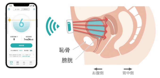 일본 스타트업 '㈜디프리'가 개발한 배변 알림 웨어러블 '디프리' 작동 원리를 설명한 시각물./사진=㈜디프리 제공