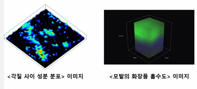 사진제공=피엔케이피부임상연구센타